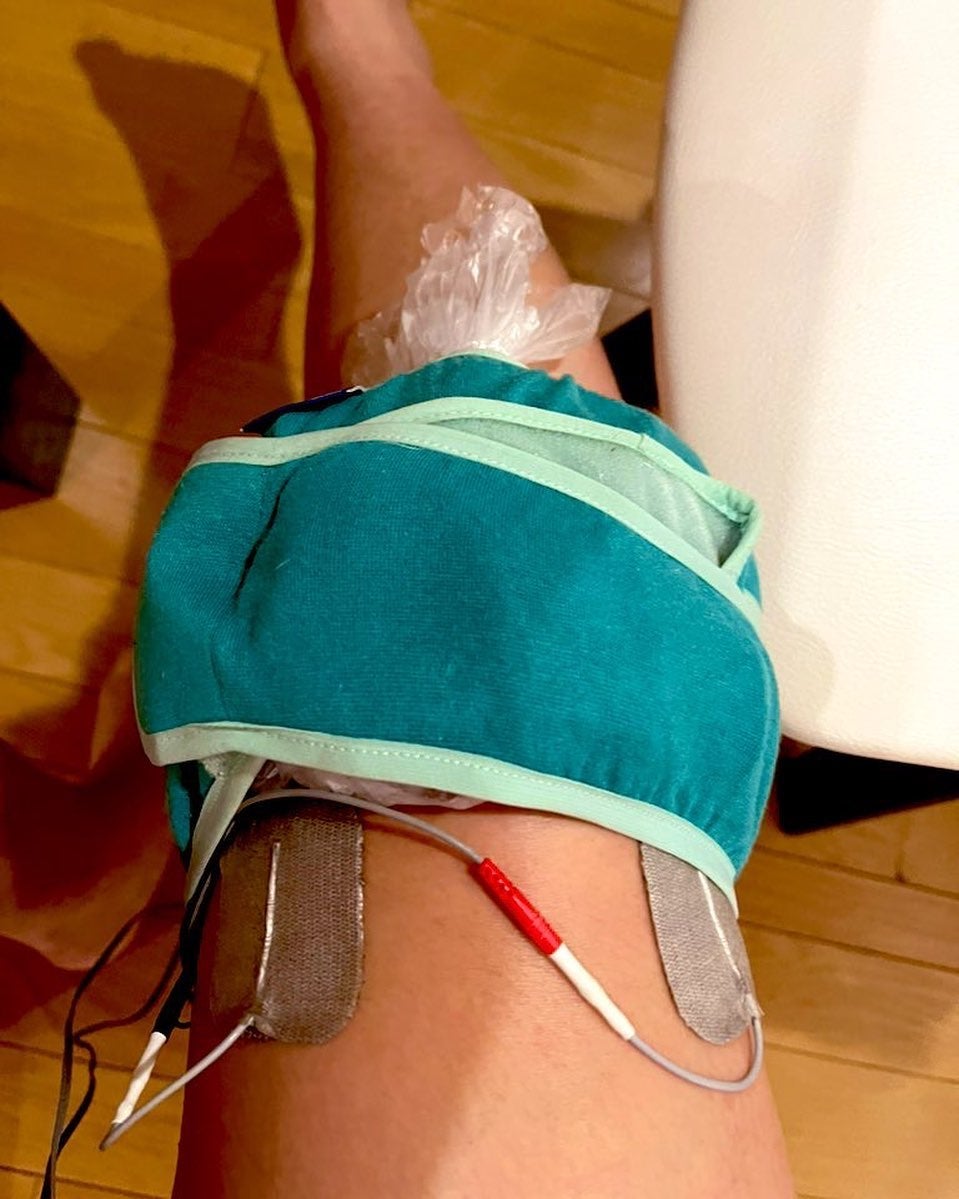 丸山桂里奈さんが膝の古傷を公開「大丈夫ですか？」の声