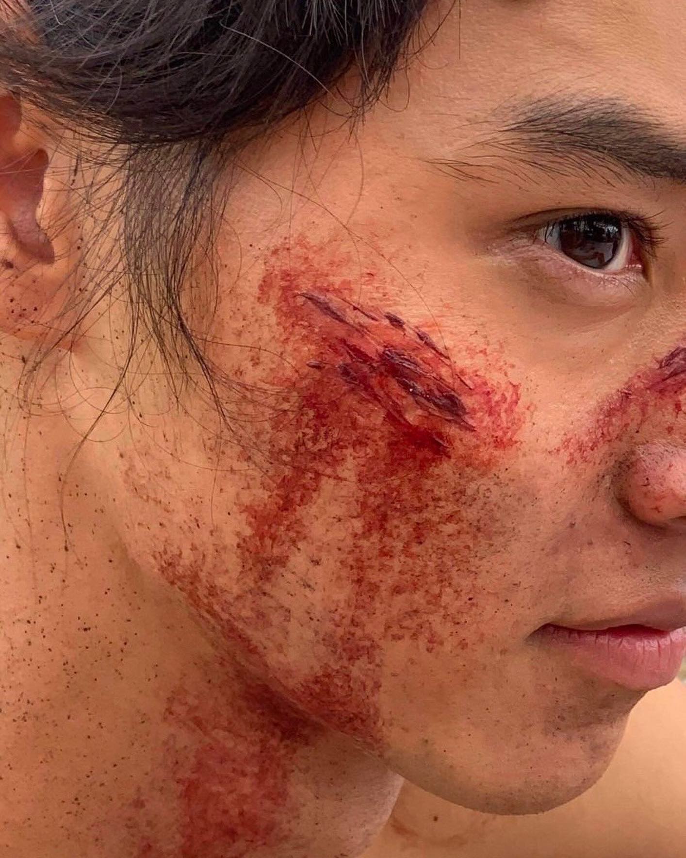 山﨑賢人さんの顔が傷だらけに…ファンから心配の声😢