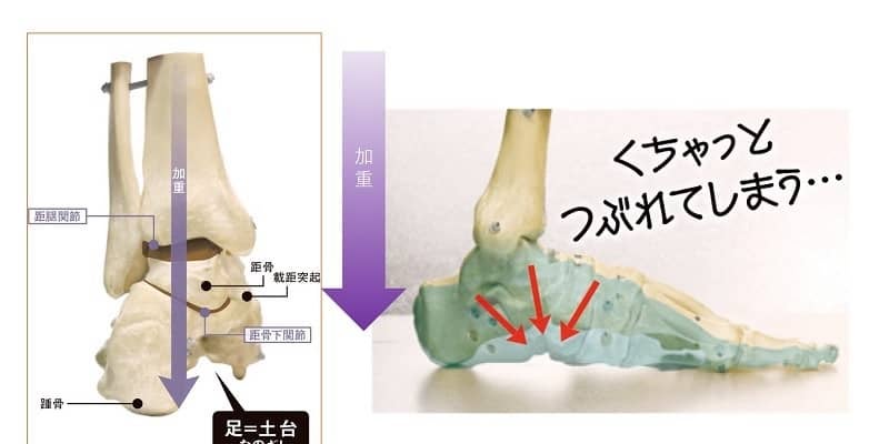 その疲れやトラブル 足のアーチが原因かも？