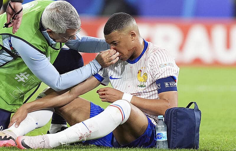 負傷交代ムバッペは鼻骨骨折の模様…デシャン監督が負傷認める