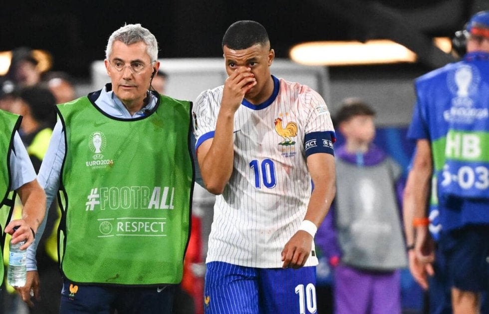 流血で鼻骨骨折も疑われたムバッペは大事に至らず…フランスサッカー連盟会長「大丈夫。手術は必要ない」