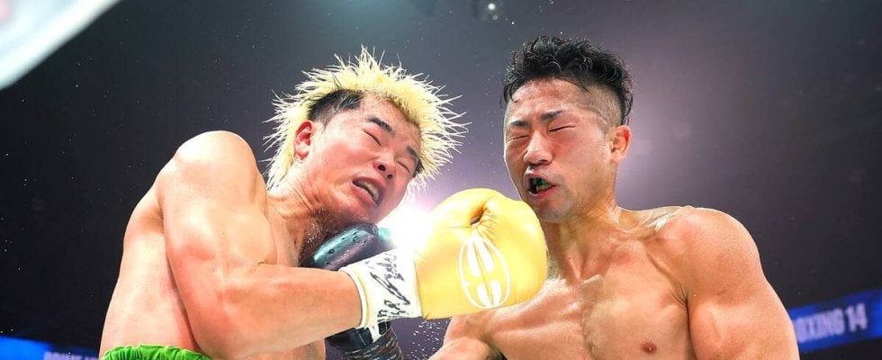 那須川天心「ダサイじゃないですか」　敗戦後の進退を問う質問に即答できっぱり