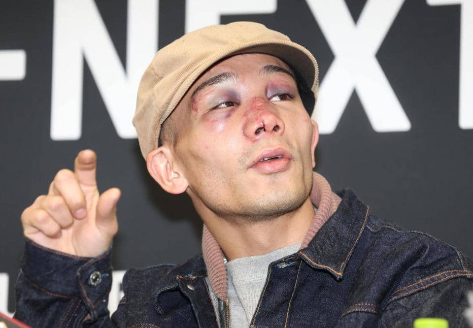 Ｖ２堤聖也、ドネアとの激闘で顔面崩壊「悲しい姿に…」鼻骨骨折＆裂傷縫合手術で４時間超　会見中に鼻血＆異例の薬タイムも「生き残れて安堵」