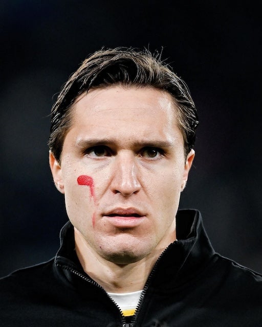 イタリア産の至宝が放出候補!? ユベントス新監督には構想外か