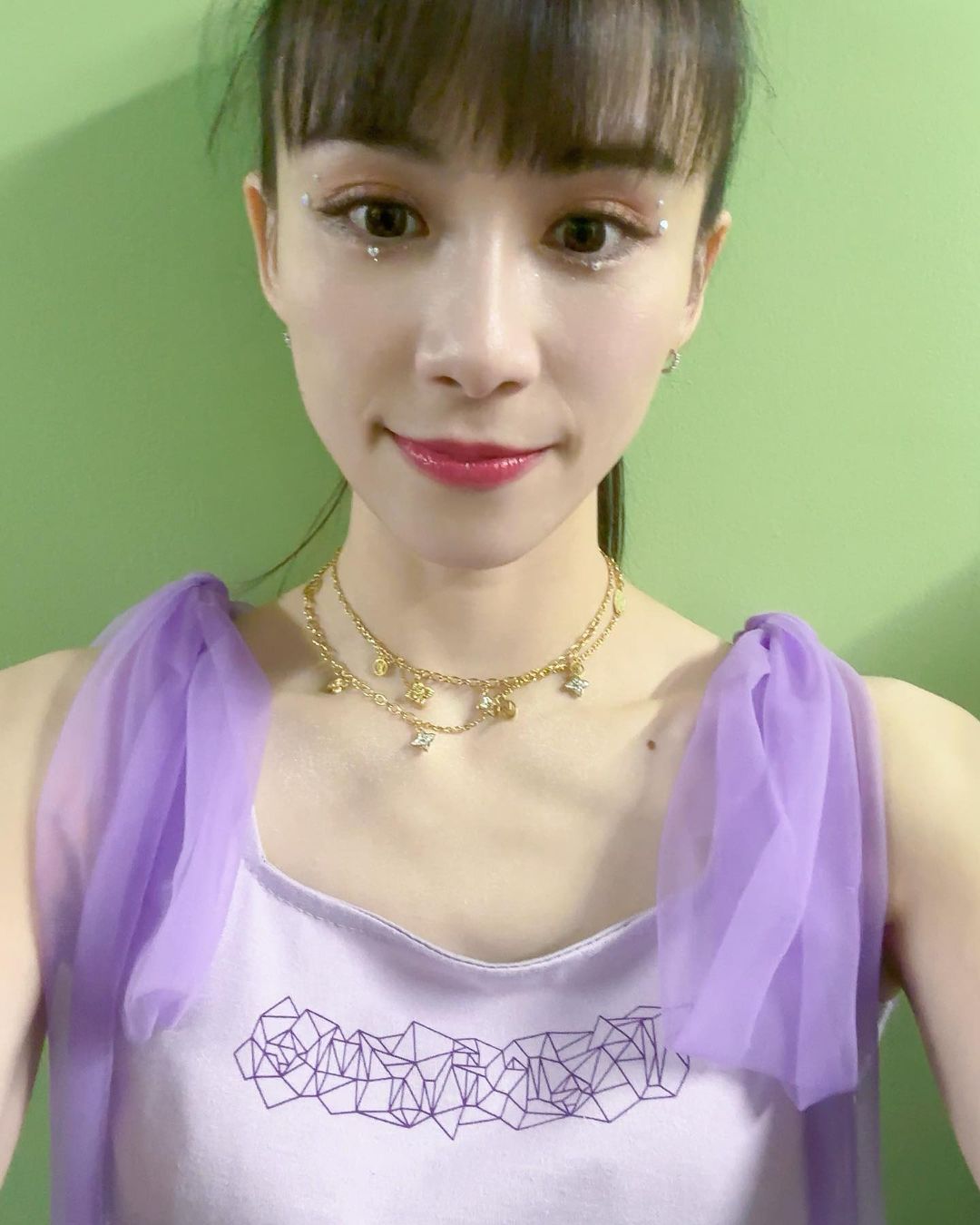 Perfume あ〜ちゃん「全治には2ヶ月くらい」骨にヒビ入り眠れない痛みを隠して踊っていた...