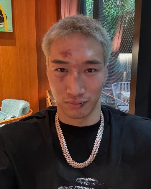 安保瑠輝也 壮絶な戦いの跡を披露