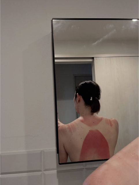 「久しぶりにヤバいくらいの日焼けを…」田中雅美、初よみうりランドプール楽しむも背中にハプニング⁉