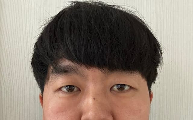 ジェラードン・かみちぃ、親知らずを抜いて顔パンパン!? 「痛かったですよね」「Cuteで天才」と反響