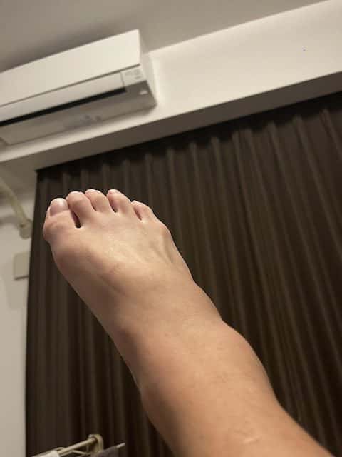 ブレイキングダウンで人気のあの人が手術の成功率25%の負傷