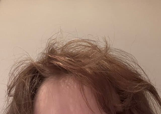 「めっちゃ爆発してる笑」FRUITS ZIPPER 早瀬ノエルが荒ぶる寝癖を公開!?