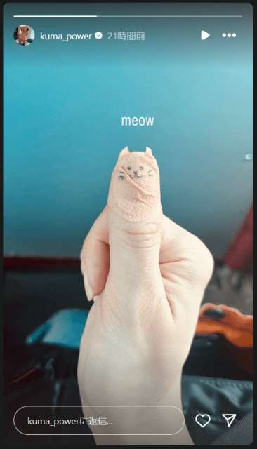 これはマネしたい！宇多田ヒカルの“ネコ型絆創膏”が可愛すぎる