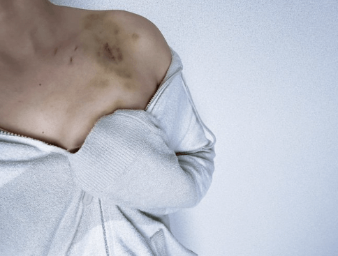 STARDOM【スターダム】レディ・C、ゾンビ化！？「ジーナゾンビに感染した」衝撃の投稿にファン反応