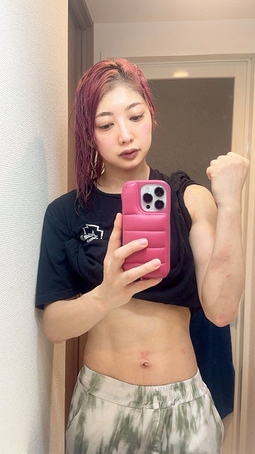 スターダム・向後桃が激戦後の写真を公開 Sareeeのフットスタンプ跡が痛々しく残る