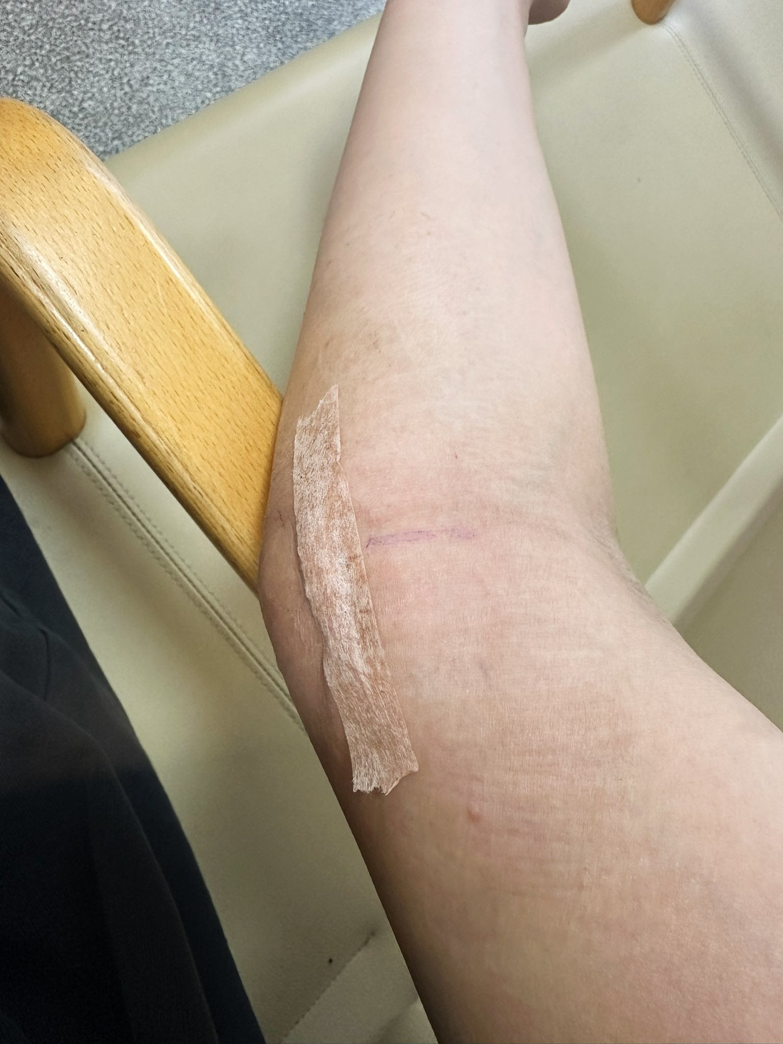 プロレスラー・朱里が術後の様子を投稿「運動はまだダメでした」