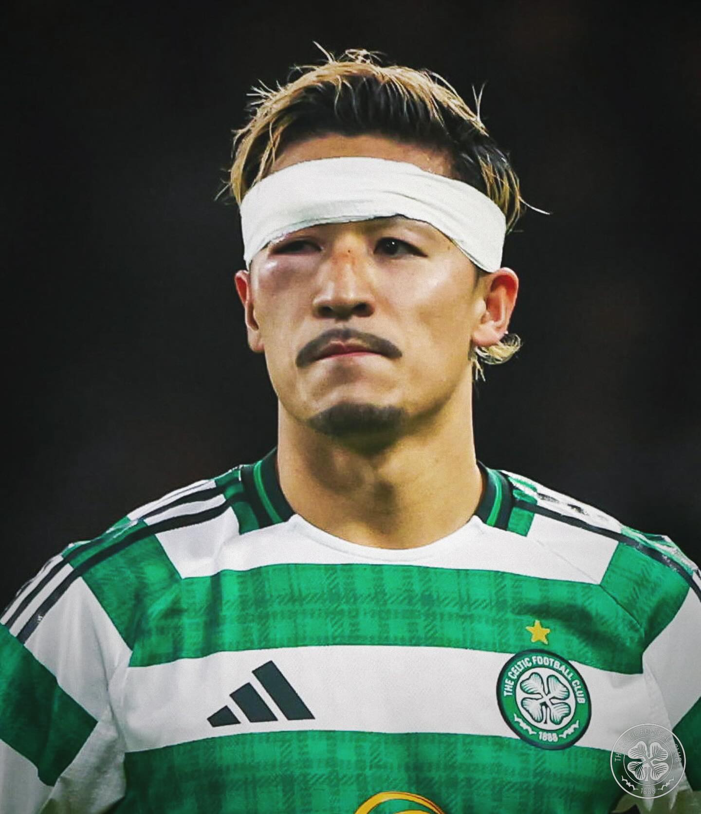 「ボクサーじゃないよ」サッカー日本代表が自身の怪我をイジる？！