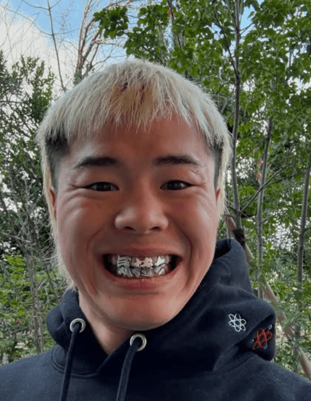 那須川天心の気合の入れた歯にファン爆笑！