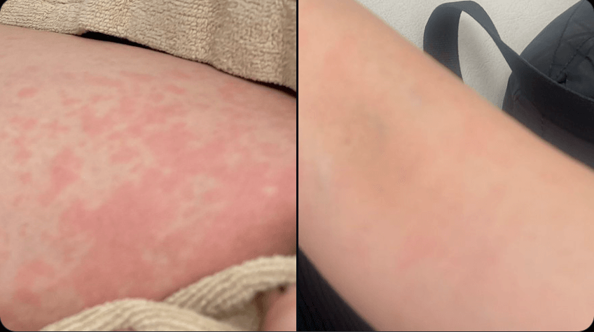 元AKB48梅田彩佳自身のX投稿に心配の声多数寄せられる。