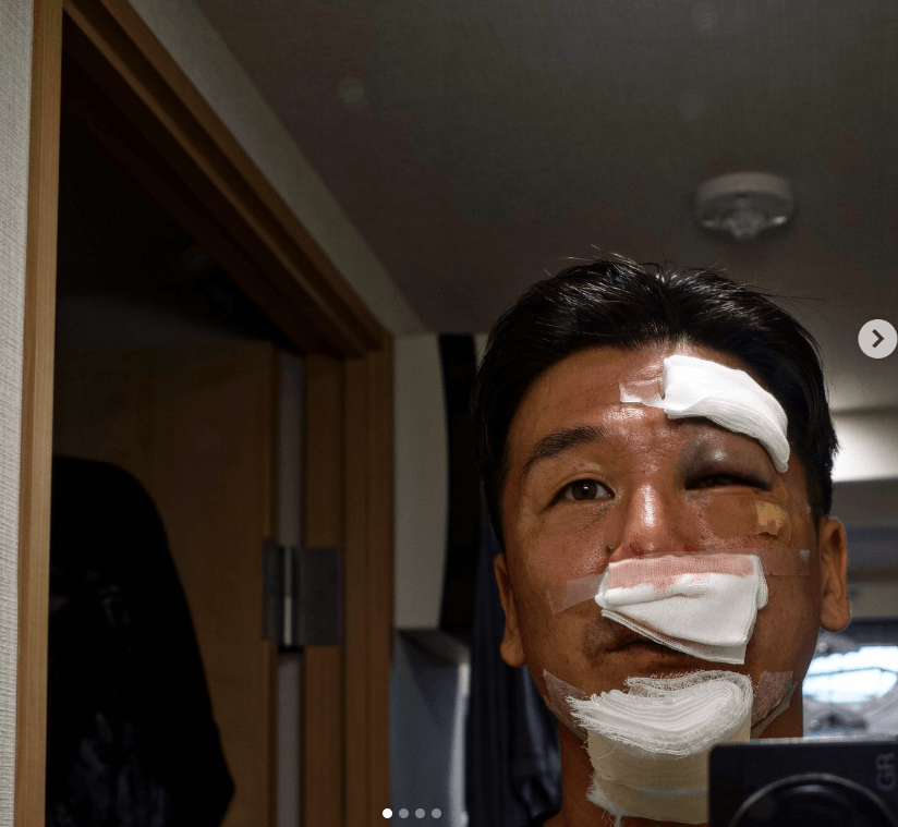 佐々木明選手、自転車事故で重傷も「練習できない心の痛みの方が辛い」