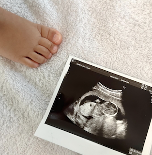 元日向坂46メンバーの第二子妊娠報告に祝福の声続々 母になった姿にファン感激