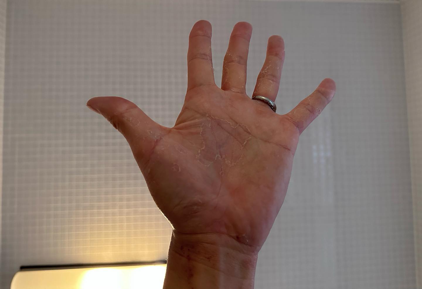 つるの剛士、手に起きた謎の症状に悩まされる…「早く治さなきゃ」