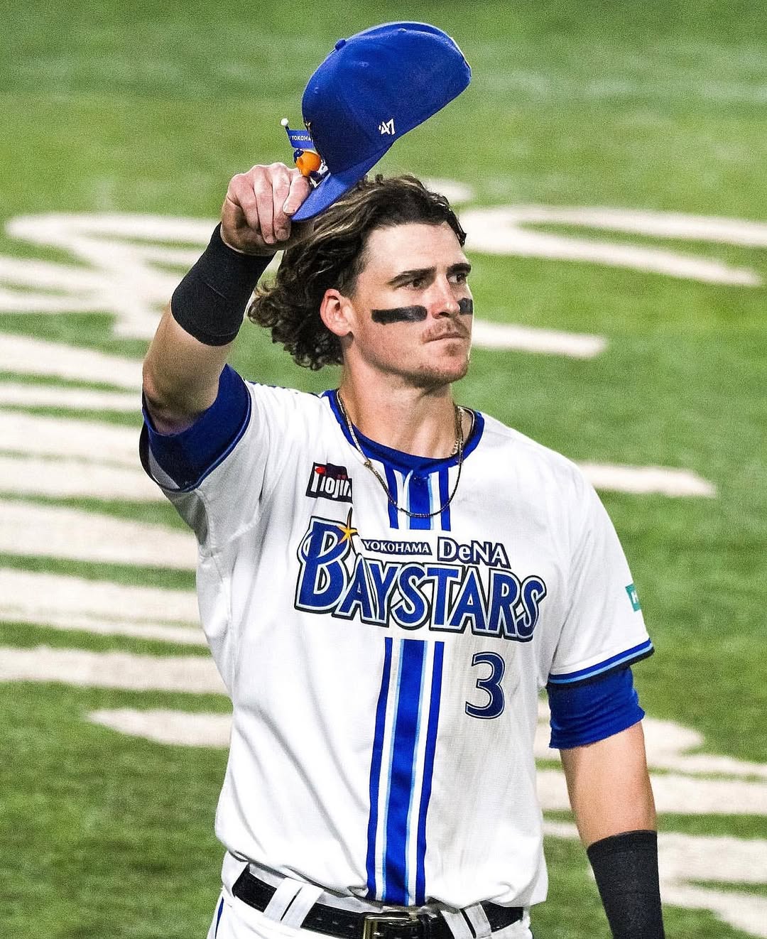 【カブス】元DeNAオースティンが開幕絶望 右膝手術で数ヶ月離脱