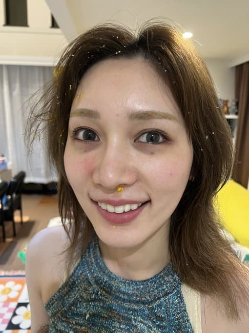 人気YouTuber・古川優香 電子レンジ大爆発で顔に火傷🤕写真公開し心配の声🗣