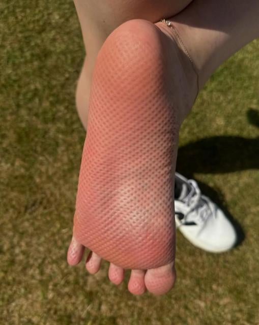 プロゴルファー・後藤未有、パッティング強化に“足裏革命”！5本指ソックスで安定感UP