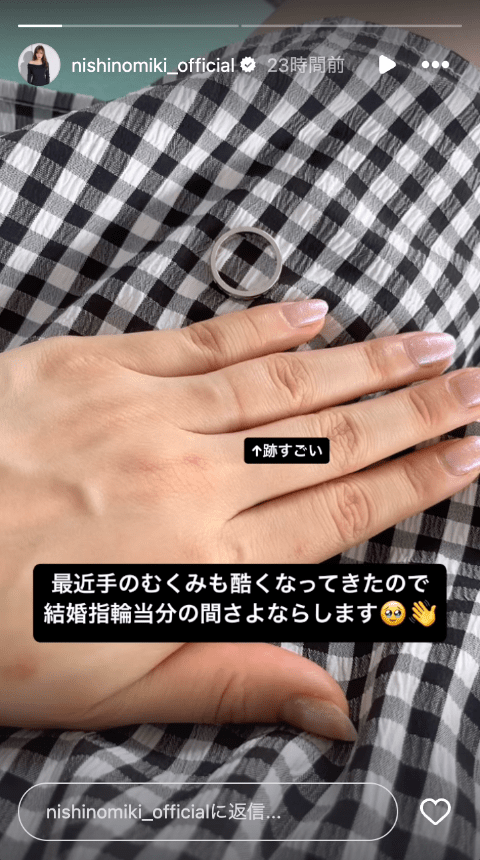 「結婚指輪当分の間さよなら」妊娠中の元人気アイドルが指輪を外した理由とは