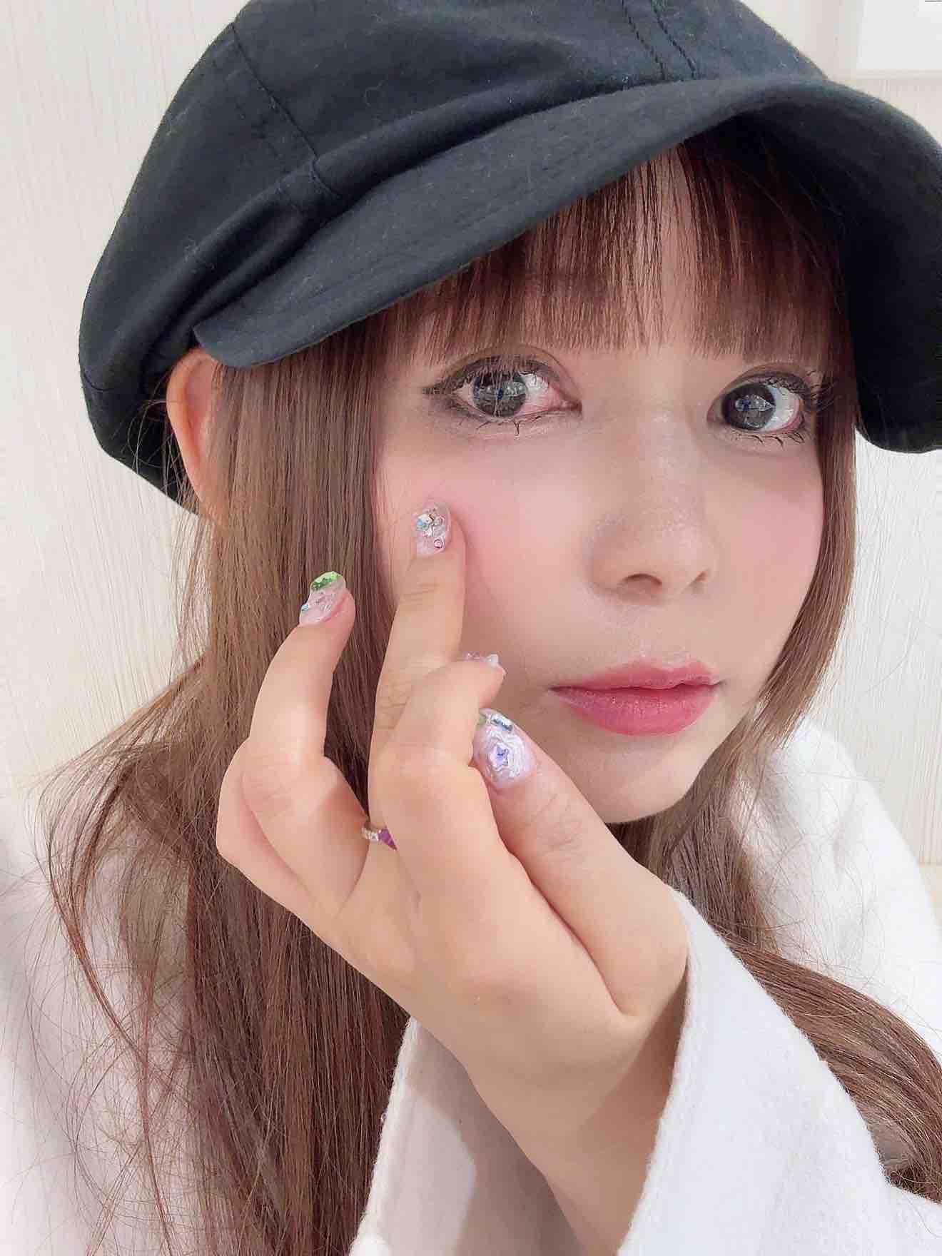 「黒目が一部白くなってしまった」中川翔子、角膜炎に 充血した目の様子に心配の声続々