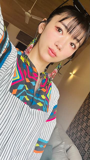 松嶋初音「なんかのアレルギーでところどころ赤いな」ファンから心配の声も