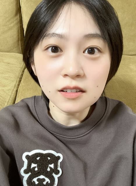 人気女性声優がハムスターに!?親知らず抜歯後の腫れ頬ショットにファン歓喜