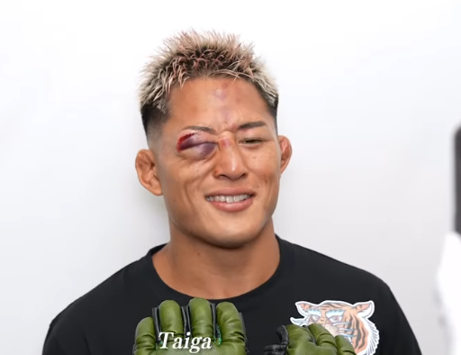 驚愕！「超RIZIN.4」で実使用グローブが続々出品中！限定オークションが熱い理由とは？