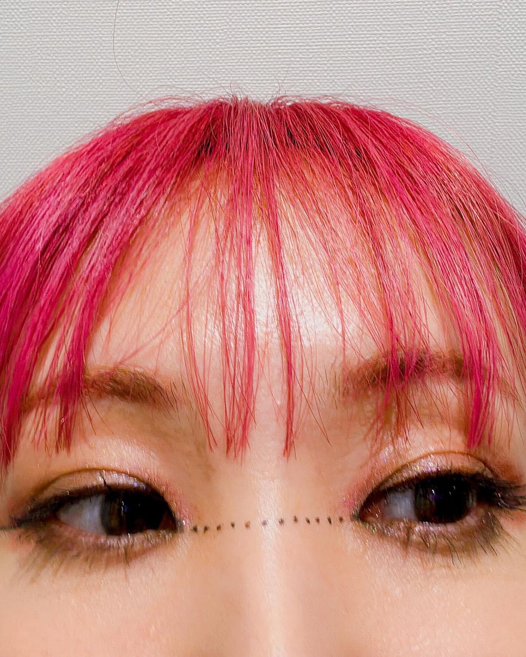 「手術を受けるのかと」あの人気歌手の”切り取り線”ショットにファン騒然