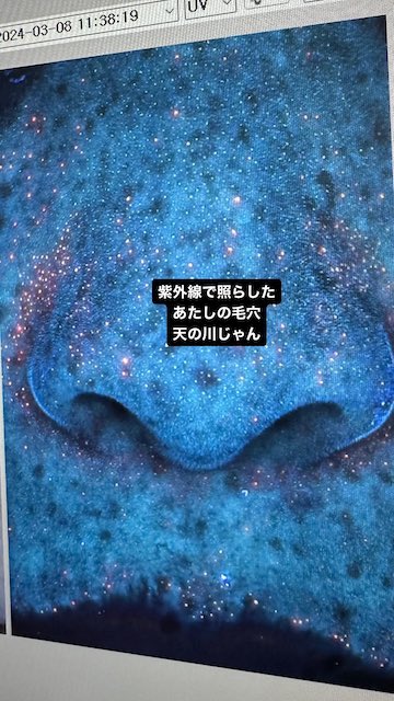 「アバターの新作かとオモタ」フワちゃんが星空にしか見えない毛穴を公開