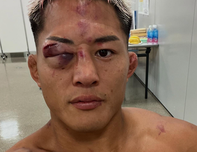 RIZIN 大雅が敗戦後も前向きコメント「この道を正解にする為、戦い続けます」