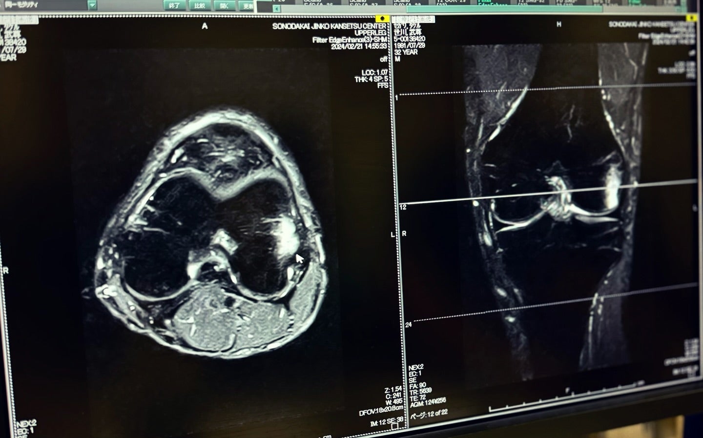 武尊、MRIの検査結果発表 足の状態は👀