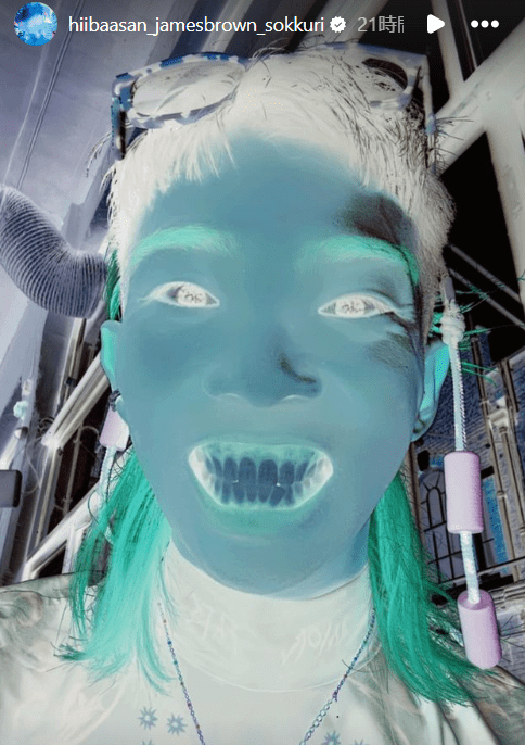 人気アーティストの顔色が変色!? まさかの自撮りショットにファン驚愕