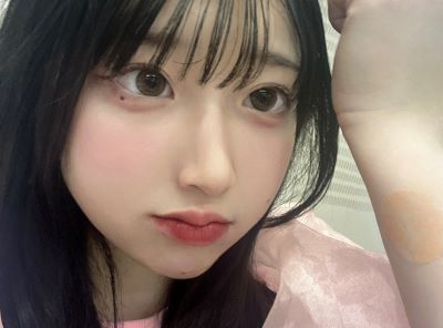 「意味わからんくらいかわいい」爆発的人気アイドル、腕の痣を心配したファンの予想斜め上を行く