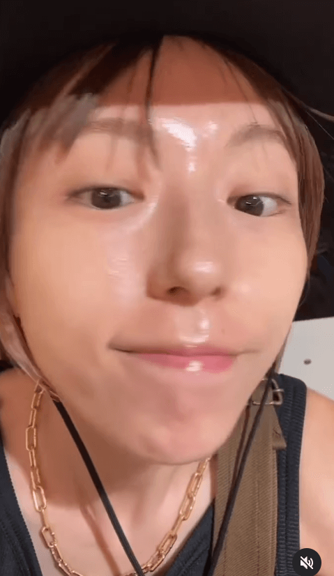 若槻千夏、美容施術を公開！シミ取りレーザーや「うめぼしボトックス」に注目集まる