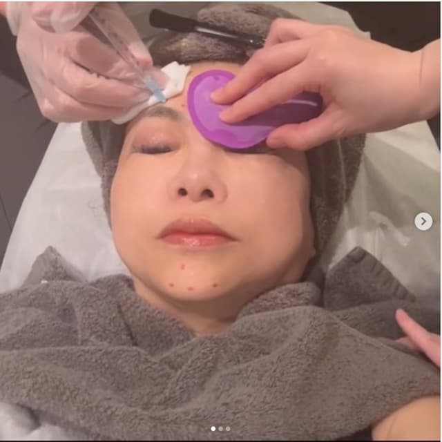 ハイヒールモモコがついにプチ整形？