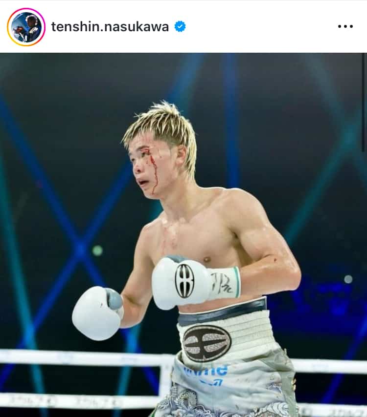 那須川天心、ボクシングで初タイトル獲得！判定勝利で次なる世界挑戦に向けて前進