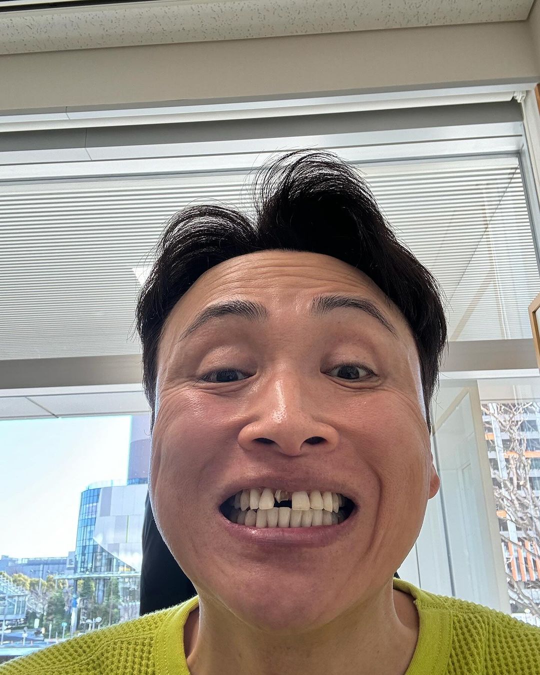 児島一哉 「生放送前の楽屋で歯折れた」ファン「即歯医者へ‼️🤣」