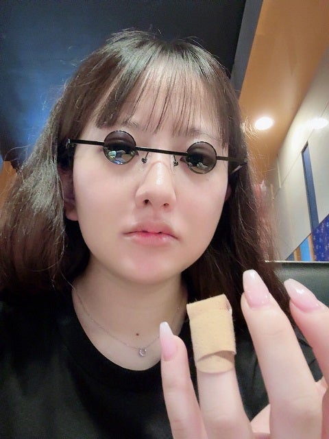 「痛すぎ」人気アイドルが