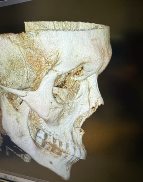 格闘家・YUSHIが驚きの事実を投稿！格闘技の恐ろしさを語る！