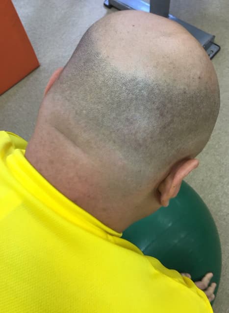 「クロちゃんこと黒川明人さん。」ビビる大木がクロちゃんの後頭部を公開