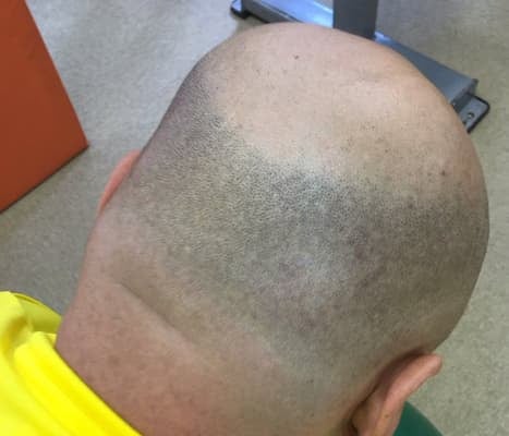 「クロちゃんこと黒川明人さん。」ビビる大木がクロちゃんの後頭部を公開