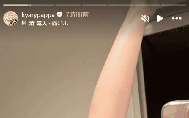 きゃりーぱみゅぱみゅ　お風呂場で転倒しあわや骨折「厄払いにいきます!」