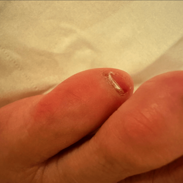 チョコプラ長田 緊急発表の「絶滅危惧種」の真相は…⁉