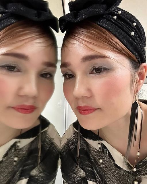 「頭皮に自信がない日」の平野ノラ、