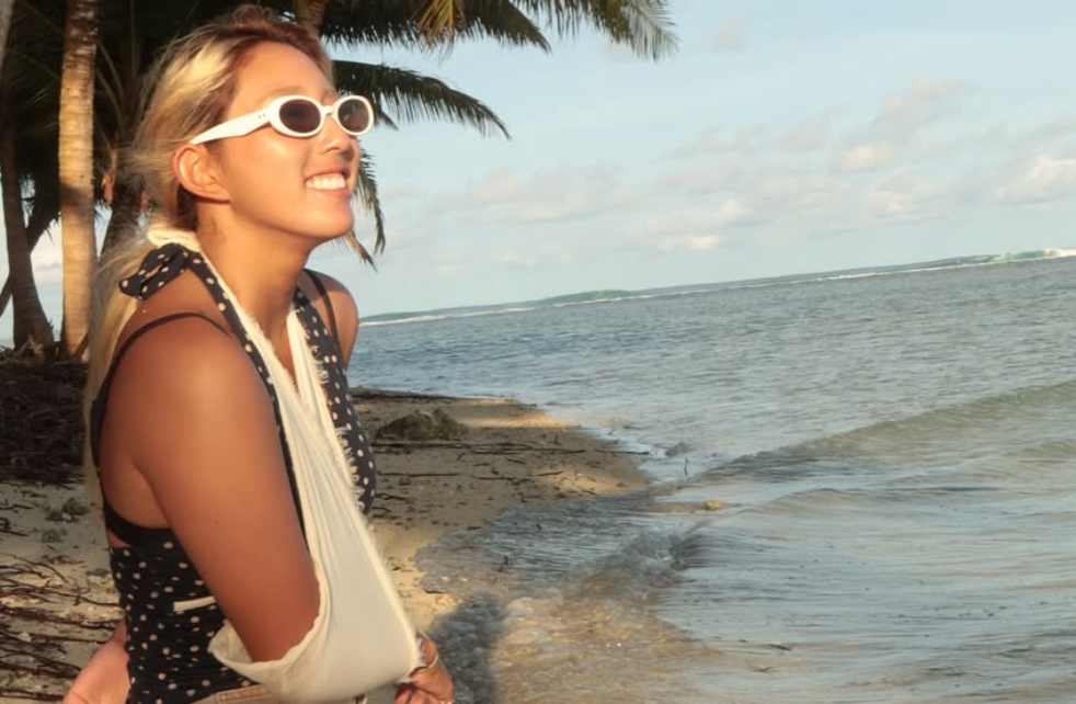 プロサーファー川合美乃里、ニアスで肩を脱臼も前向きな笑顔「次はリベンジしたい」